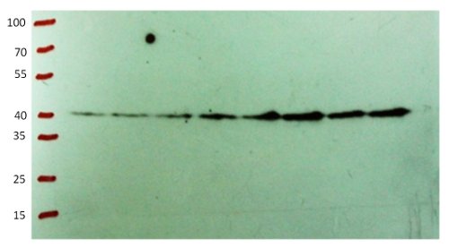 western blot using anti-CHS antibodies